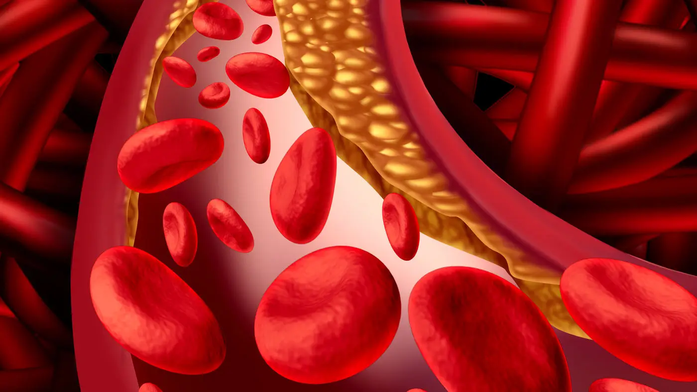 Colesterolo alto al mattino? Il frutto che aiuta a riportarlo subito sotto controllo